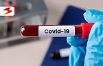 COVID-19: 147 са заразените за денонощието у нас
