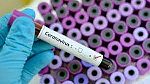 Новите случаи на COVID-19 у нас за последното денонощие са 49