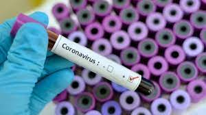 Новите случаи на COVID-19 у нас за последното денонощие са 49