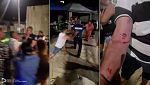 Полицията използва сълзотворен спрей след бой с цигани в Балчик
