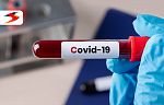 168 души са заразени в последните 24 часа с COVID